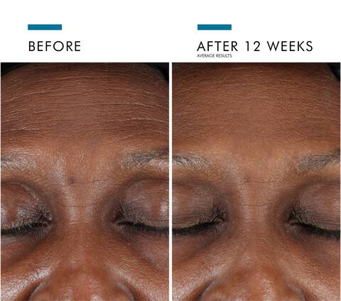 SkinCeuticals A.G.E. Interrupter Advanced