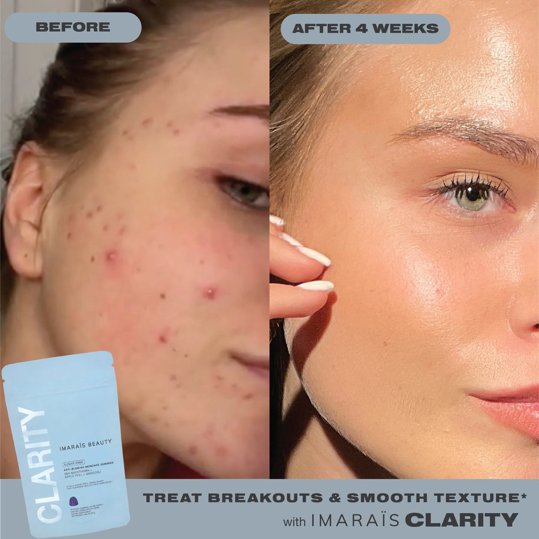 IMARAÏS Beauty Clarity