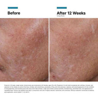 SkinCeuticals H. A. Intensifier Multi-Glycan