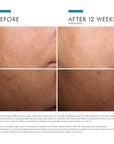 SkinCeuticals Discoloration Defense