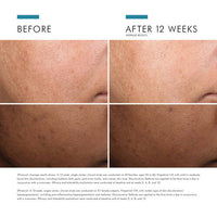 SkinCeuticals Discoloration Defense