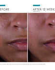 SkinCeuticals Silymarin CF