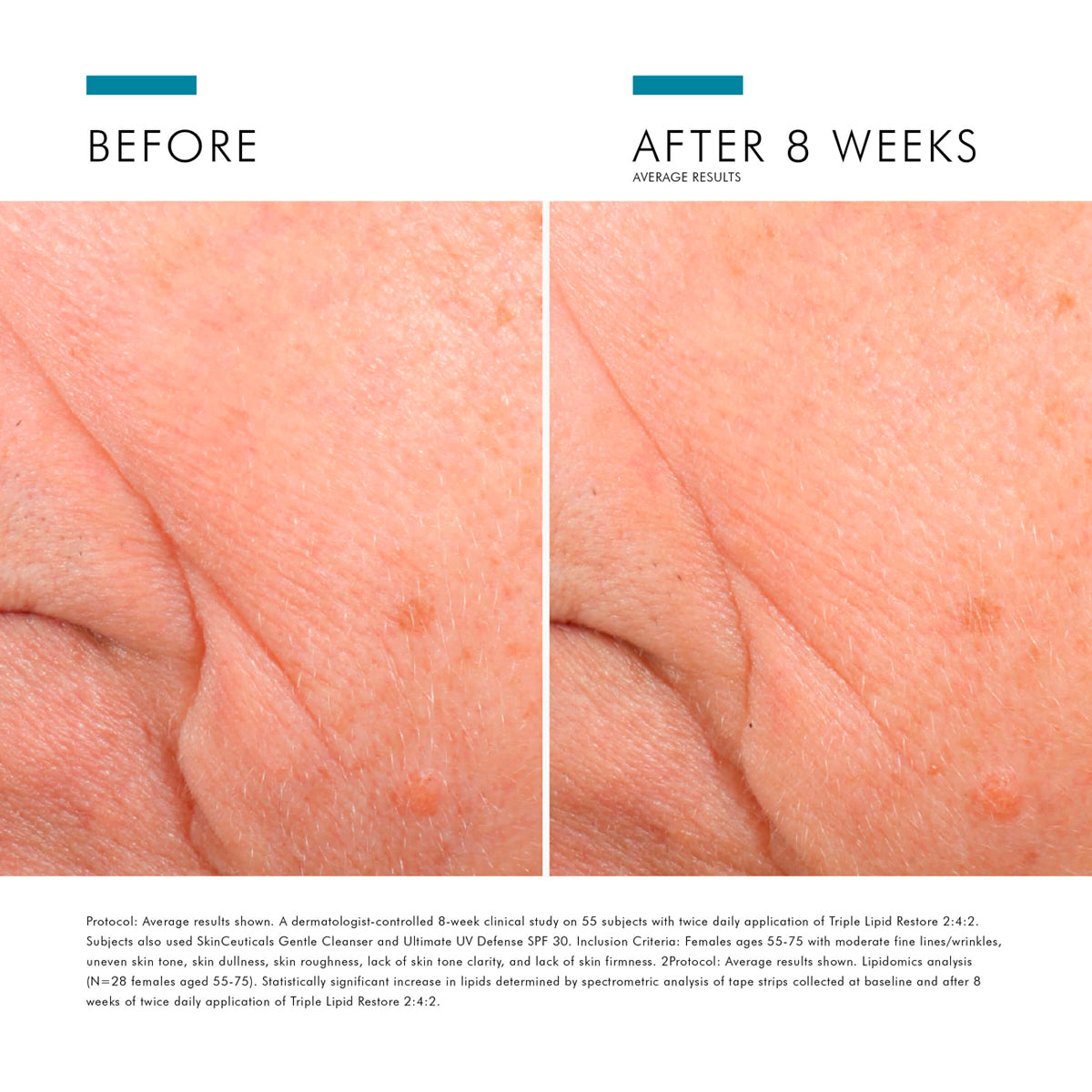 SkinCeuticals Triple Lipid Restore 2:4:2 – Hammam Spa by Céla