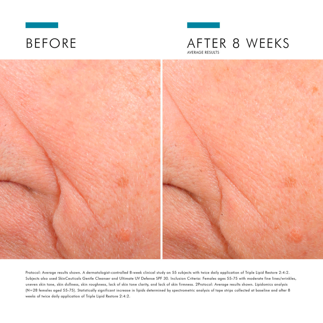 SkinCeuticals Triple Lipid Restore 2:4:2