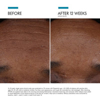 SkinCeuticals P-Tiox Serum