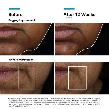 SkinCeuticals A.G.E. Interrupter Ultra Serum – Hammam Spa by Céla