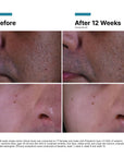 Skin Ceuticals P-Tiox Anti Wrinkle Cream