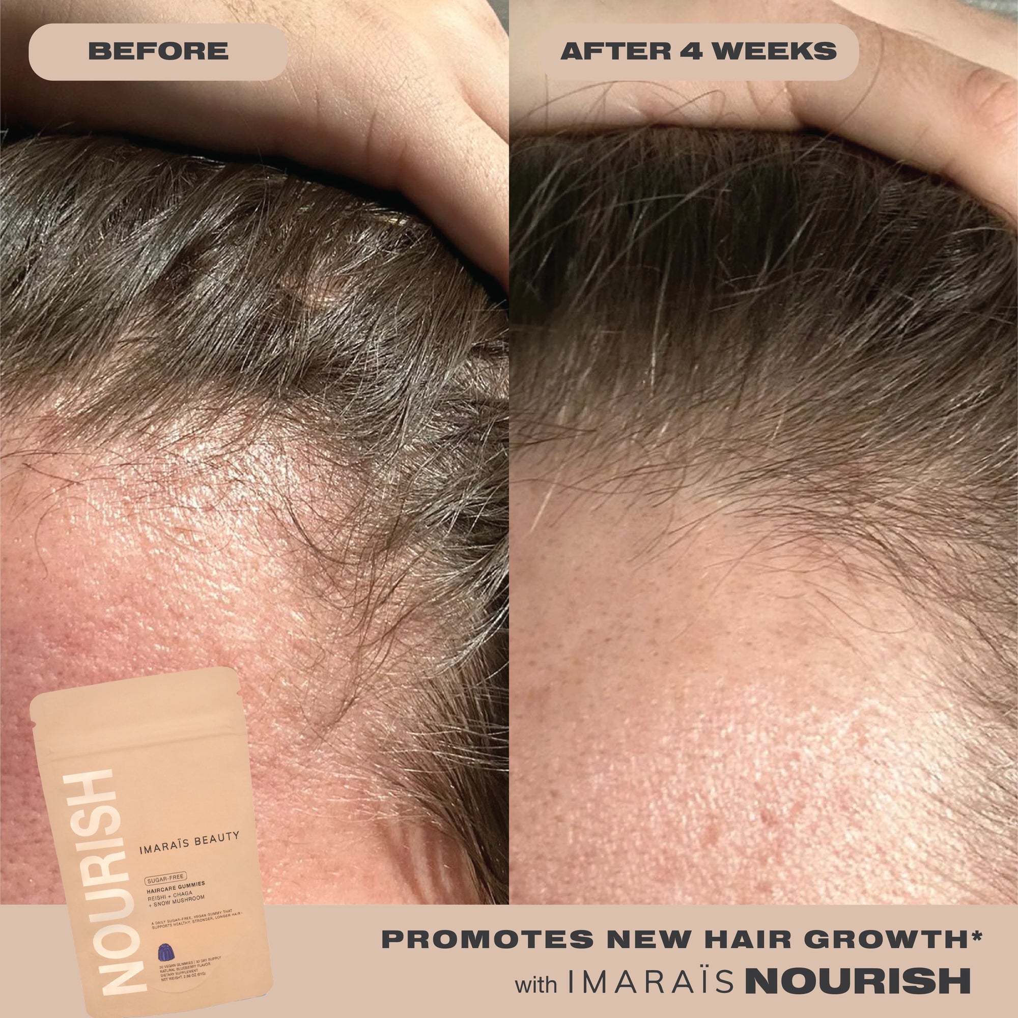 IMARAÏS Beauty Nourish