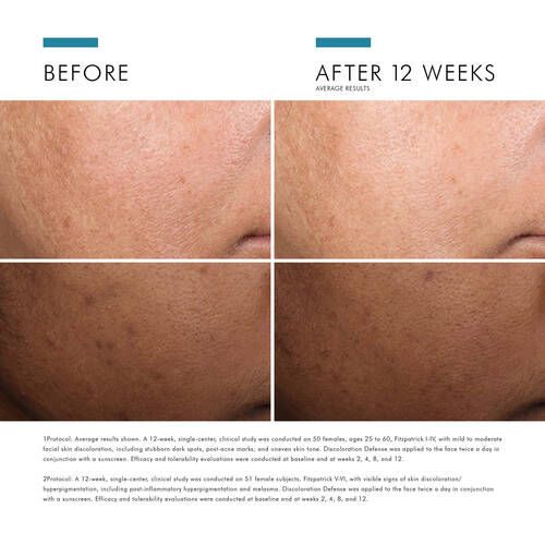 SkinCeuticals Discoloration Defense