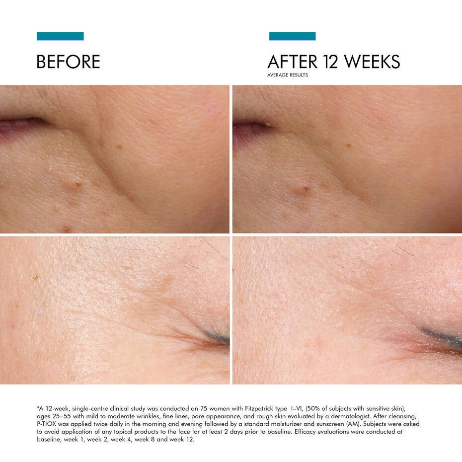 SkinCeuticals P-Tiox Serum – Hammam Spa by Céla