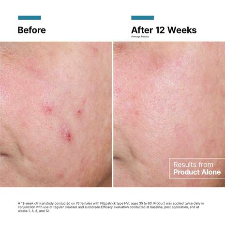 SkinCeuticals Advanced RGN-6