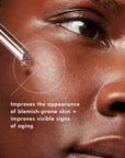 SkinCeuticals LHA Serum
