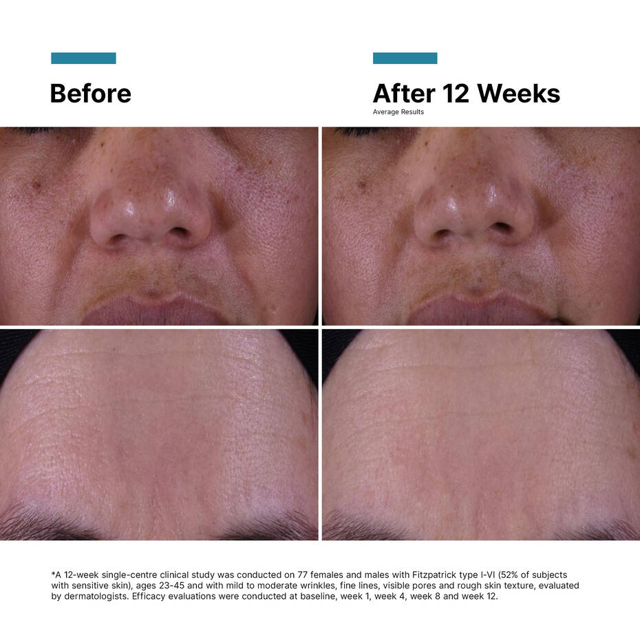 Skin Ceuticals P-Tiox Anti Wrinkle Cream