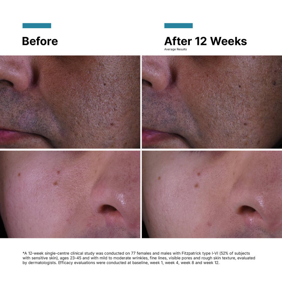 Skin Ceuticals P-Tiox Anti Wrinkle Cream