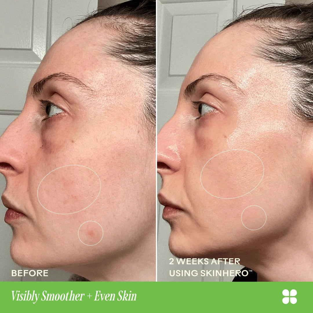 SkinHero Calendula + 2% Bakuchiol Bio-Retinol Serum